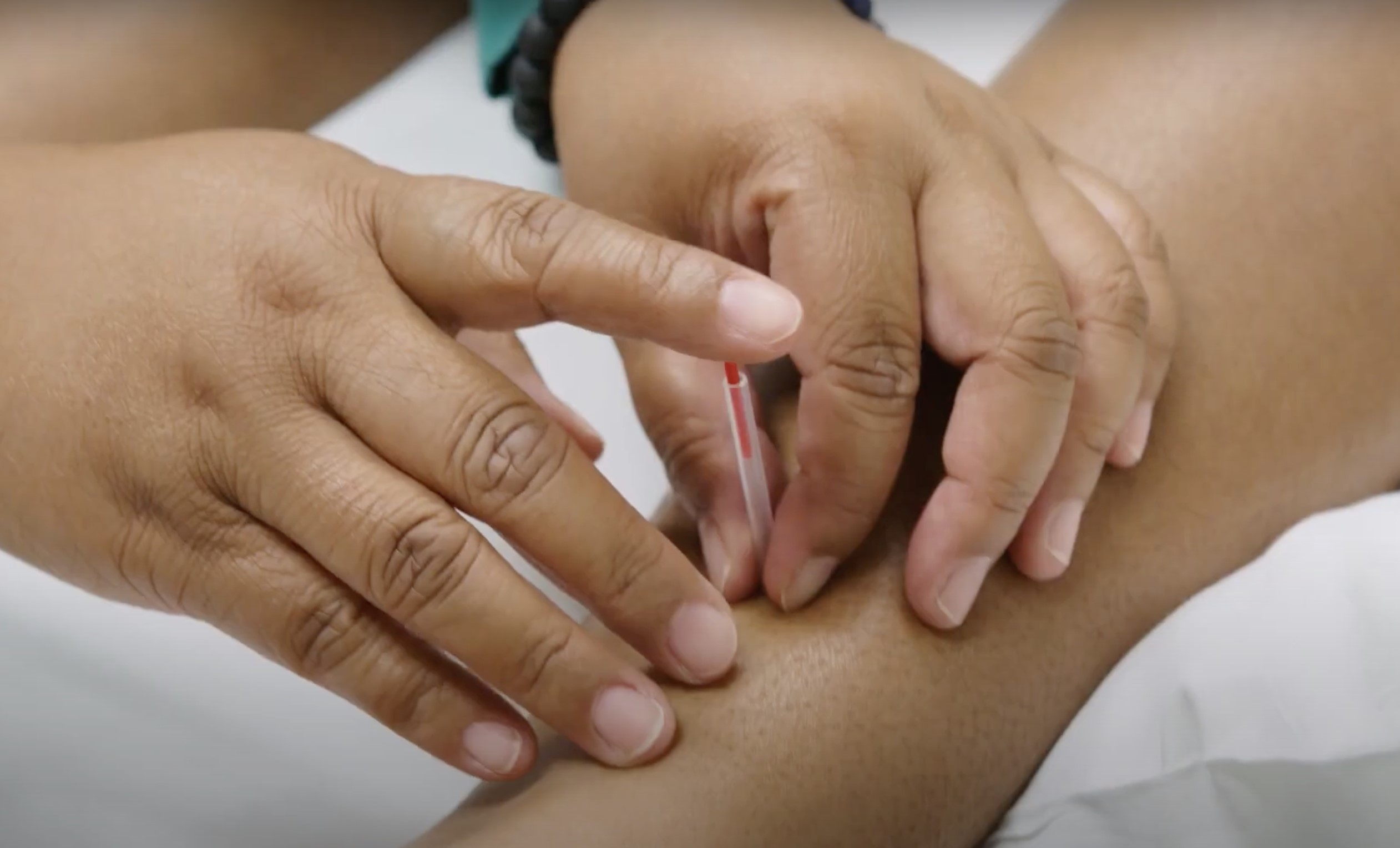 Acutherapy Fellowship Program