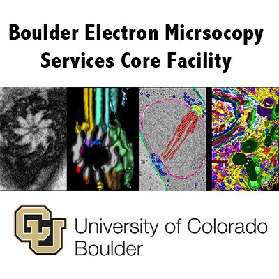 Boulder Electron Microscopy Services Core Facility (BEMS)