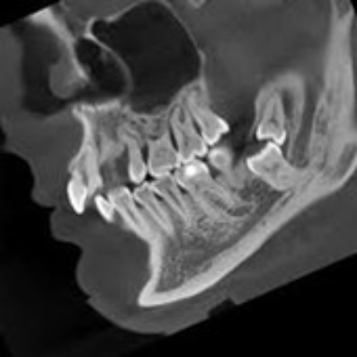Oral and Maxillofacial Surgery Club